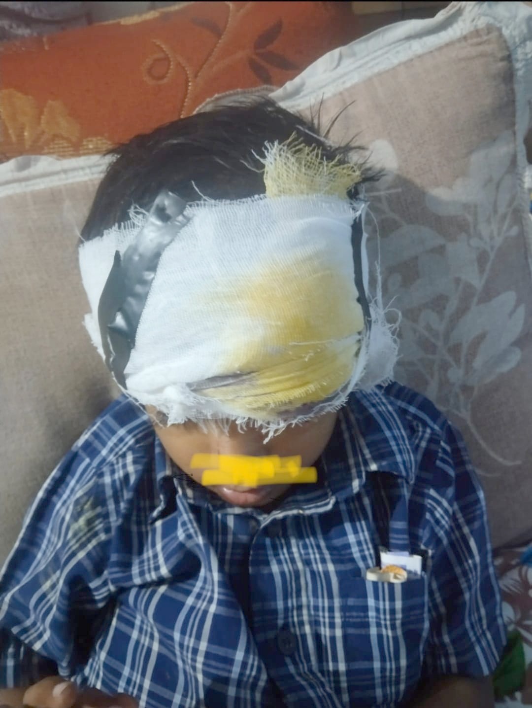 ગણદેવીમાં રખડતા શ્વાનોઍ બાળકને બચકા ભરતાં ગંભીર